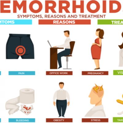 Explainer: why do people get haemorrhoids and how do you get rid of them?