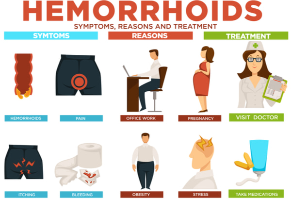 Hemorrhoids symptoms, reasons, and treatment