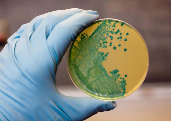 Listeria germs growing on an agar plate